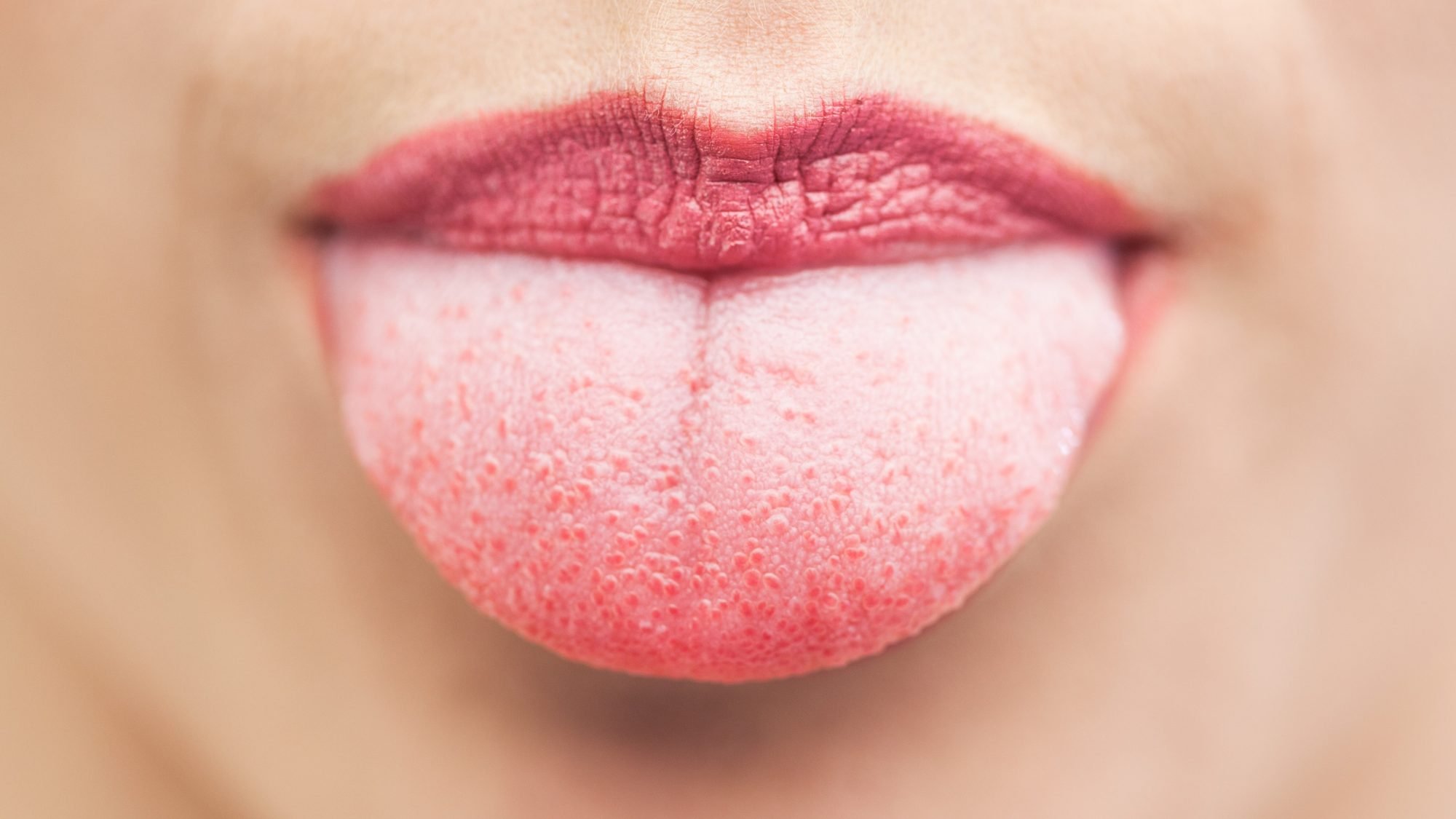 What the Color of Your Tongue Can Tell You About Your Health 1