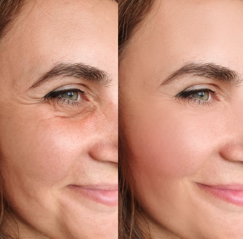 No Needles, No Stress: Skin Tightening for Everyday Beauty 4